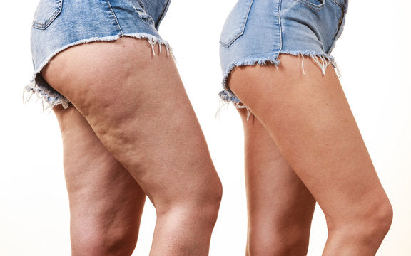 Cellulite et drainage naturel - 3 produits BIO L'ApoTea'Care : Phyto-complexe n°21, Piloselle et infusion Fit Silhouette